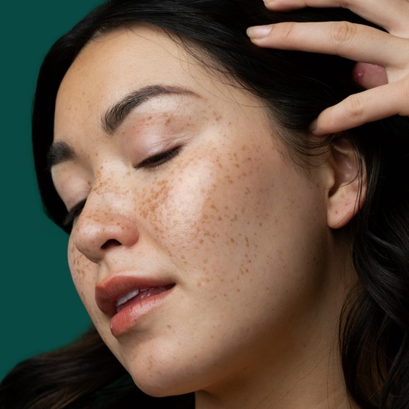 itk Broad Spectrum - Picture 9 of 10